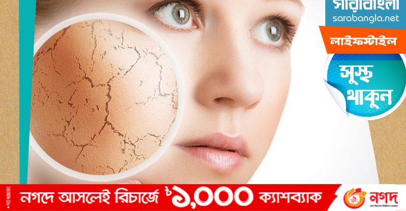 wm LifeStyle Sustho Thakun Dry Skin 10.01.2023