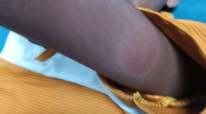 চট্টগ্রামের আনোয়ারায়/  মাদ্রাসাছাত্রকে কিল-ঘুষি মেরে হাসপাতালে পাঠালো প্রতিবেশী