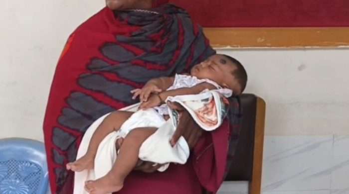 ভূঞাপুরে এক মাসের শিশু বাচ্চা কে নিয়মিত টিকার পরিবর্তে দেওয়া হয় কুকুর কামড়ানোর ভ্যাকসিন