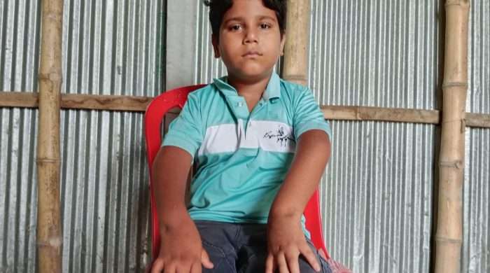 স্বাভাবিক জীবনে ফিরতে চায় শিশু মাসুদ, চিকিৎসার জন্য সহায়তার আবেদন