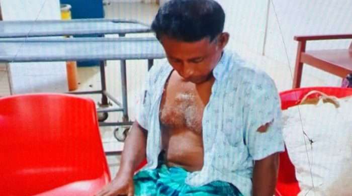 কৃষকের পা ভেঙ্গে দিলো হাতুরি দিয়ে