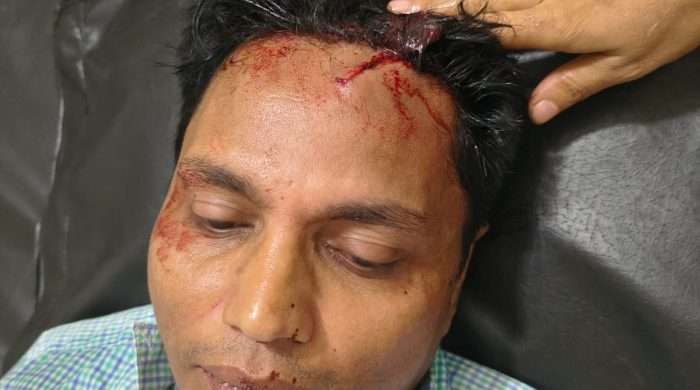 কালিয়াকৈরে সংবাদ সংগ্রহ করার সময় এস এ  টিভির উপজেলা প্রতিনিধি সহ আহত ২