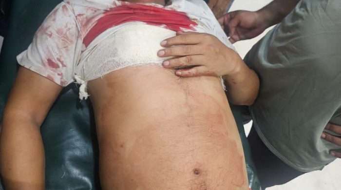 নোয়াখালীতে মাদকের বিরুদ্ধে প্রতিবাদ করায় যুবদল নেতাকে কুপিয়ে জখম